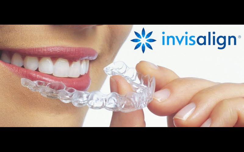 4 Tratamientos Dentales Innovadoras