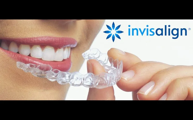4 Tratamientos Dentales Innovadoras