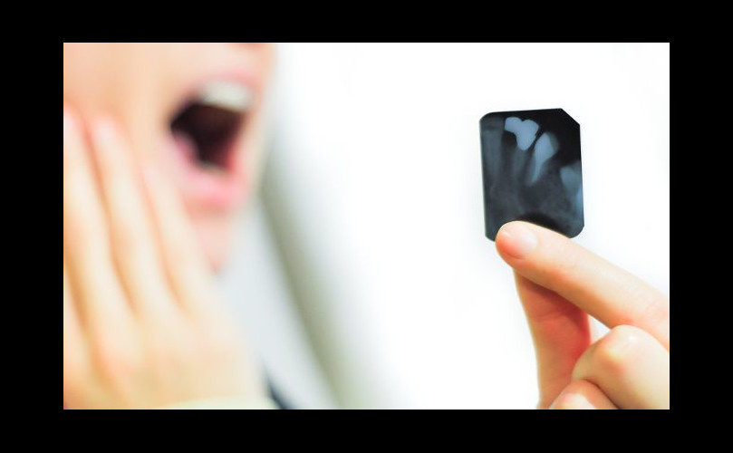 Como se hace una endodoncia