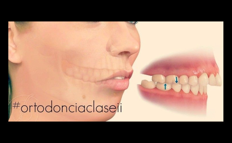 Como afectan a los dientes los malos hábitos de los niños
