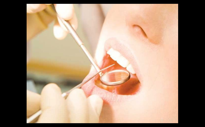 Cuidados tras una cirugía de colocación de implantes