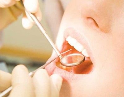 cuidados tras colocacion de implantes dentales