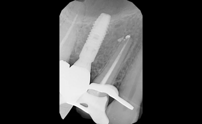 Nosotros Salvamos Dientes