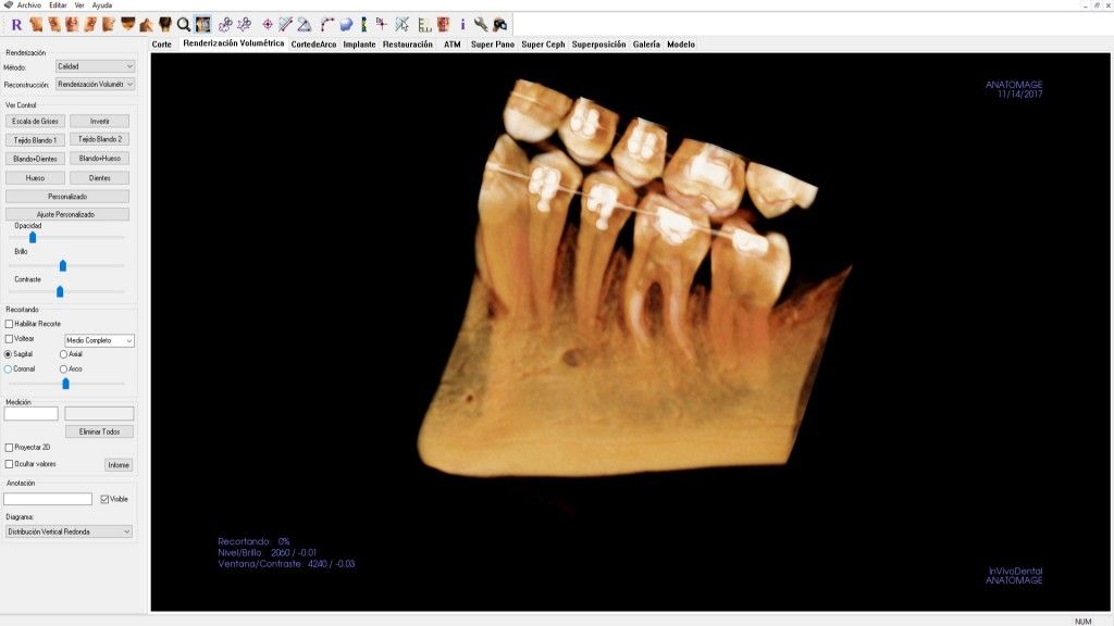 radiografía para ortodoncia